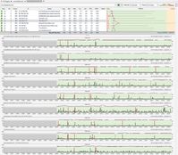 Pingplotter via facebook 03.09 22.06 Modem direkt small.jpg